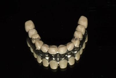 Full Ceramic Zirconia Implant Bridge with High Aesthetic