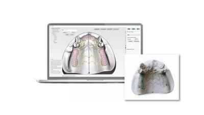 3D Dental Printer with CAD&CAM Software for Dental Lab