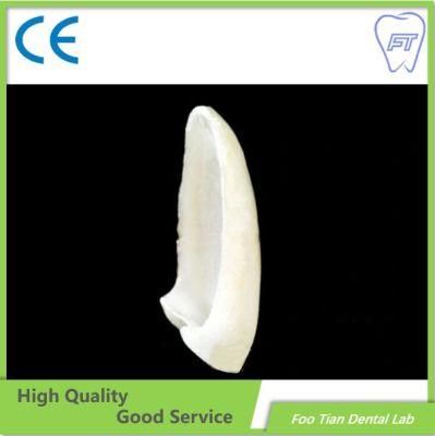 Foo Tian Brand Orthodontic Products Dental Material Supplies Implant Emax Ceramic Inlay/Onlay From China Dental Lab