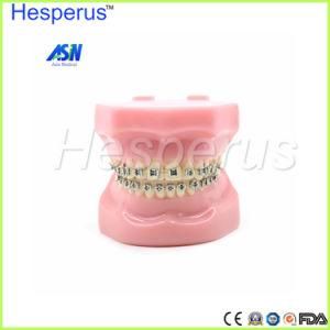 Dental Orthodontics Typodont Teeth Model Metal Brace Bracket Typodont with Arch Wire Hesperus