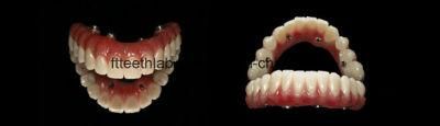 Dental Material Lab Implant Dental Lab Custom Hybrid Denture Made in China Dental Lab