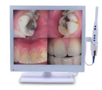 Intra Oral Camera Medical Dental Equipment WiFi Wireless Intraoral