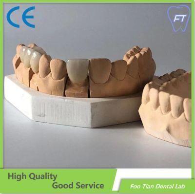 Dental Product Bridge and Zirconium Crown Custom Dental Material Lab Implant Full Contour