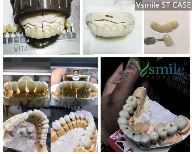 Vsmile St Super Translucent White Blank Zirconia Blocks Discs for 98mm Open CAD Cam