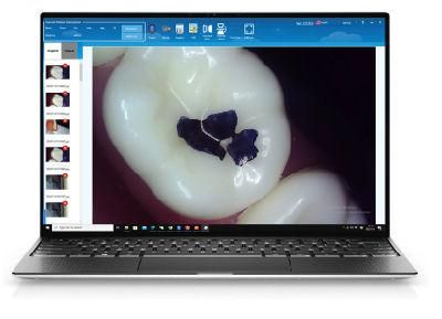 CE Approved Medical Dental Intraoral Camera High Pixel Super Clear Image 10 LEDs