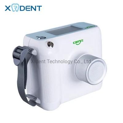 Dental Supply Medical Portable Digital Dental X Ray Equipment