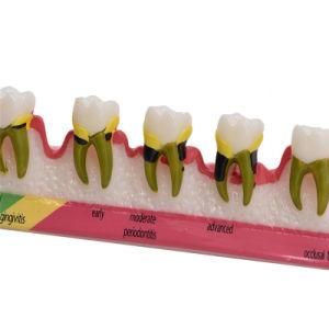 Dental Human Tooth Model Human Demo Teeth Model/ Medical Anatomy Model