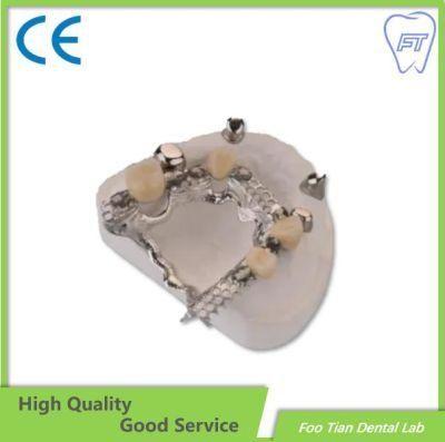 Good Service From Foo Tian Zirconia Abutment Dental Abutment Dental Implant