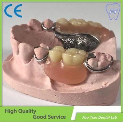 Customized Removable Denture Dental Implant Good Product