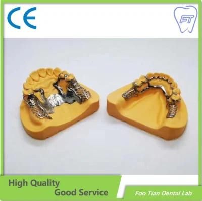 Dental Cast Partial Framework