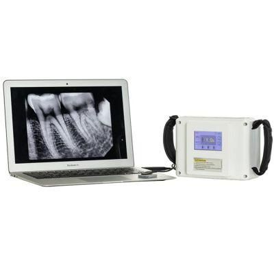 Portable Dental Wireless Intraoral Digital Dental X Ray Machine