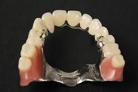 Dental Removable Acrylic Dentures From Midway Dental Lab
