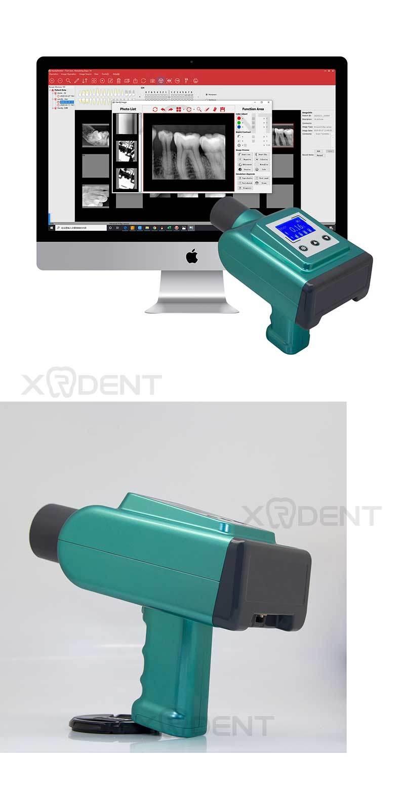 New Pistol-Style 60kv Dental Portable X-ray Machine