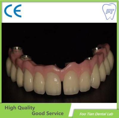 Factory Price Zirconia Crown and Bridge Made From China Dental Lab