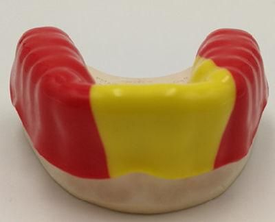 Athletic Mouth Guard/ Sport Guard From Midway Dental Lab