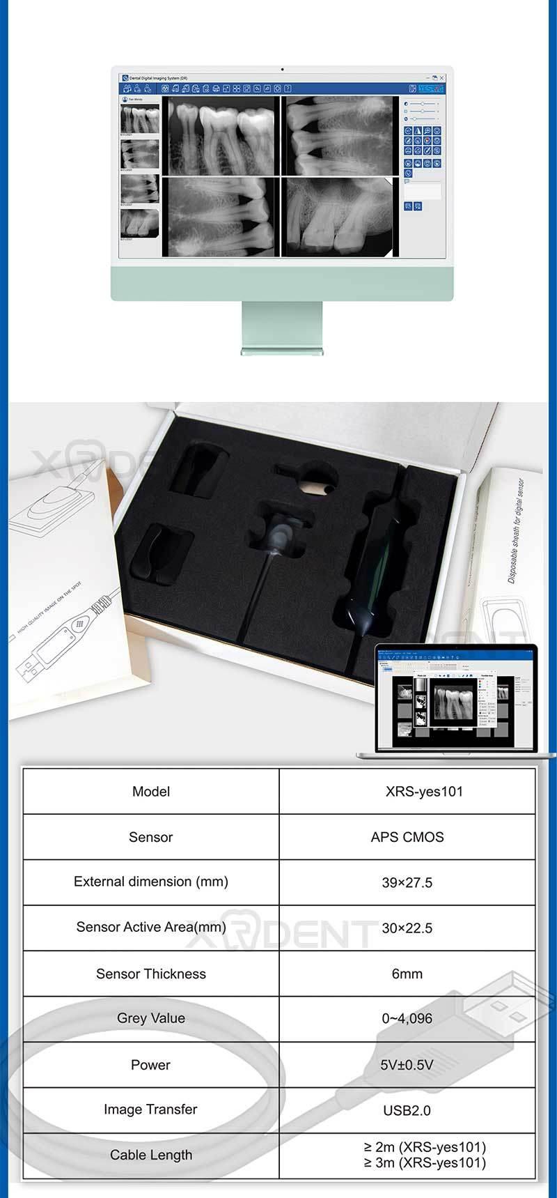 Yes-Rvg High Quality Intraoral Sensor