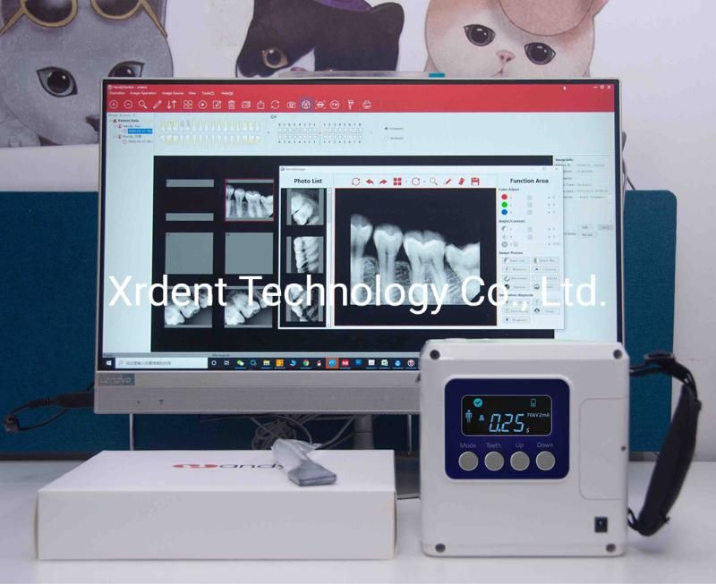 Top Quality Safe Portable X-ray Dental Digital Xray Machine Can Work with Sensor