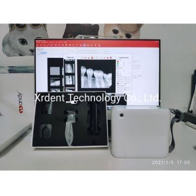 Digital X Ray Imaging Portable Handheld Dental X Ray Machine for Sale