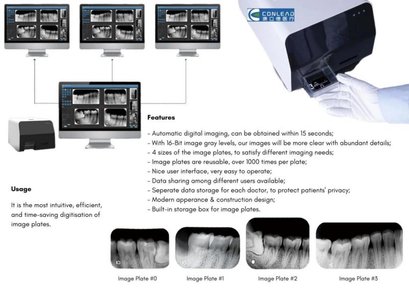 Automatic Dental Digital Intraoral Cr Imaging Plate Scanner