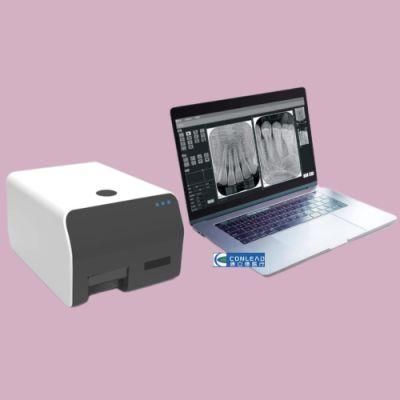 Portable Dental X-ray Scanner Medical Radiovisograph Digital Sensor, Matching Size 0# 1# 2# 3# Imaging Plate