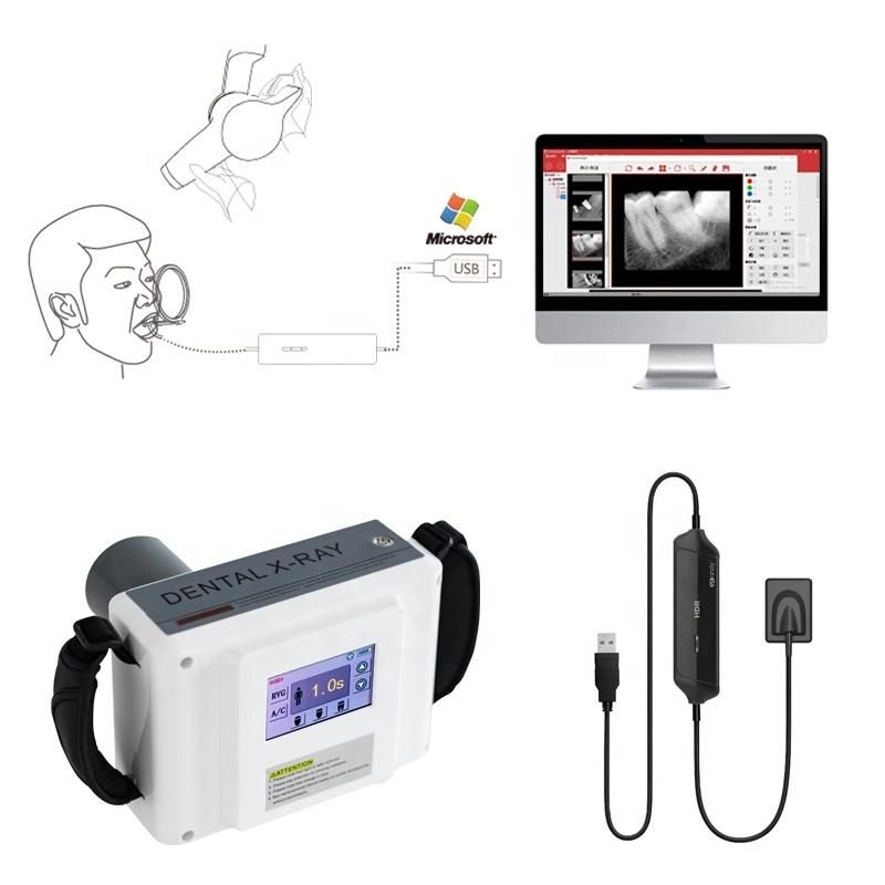 Dental Portable Digital Wireless Dental X-ray with Sensor