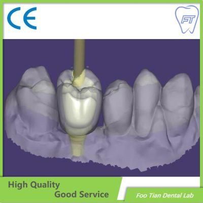 Customized Aesthetic Dental Zirconium Bridges From China Dental Lab