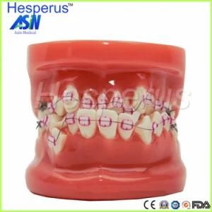 Ortho Dontists Model with Metal Brackets Irregular Teeth Hesperus