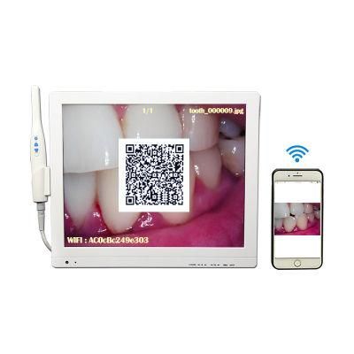 The Spring Wire Handle of Medical Dental Camera Is More Convenient to Use