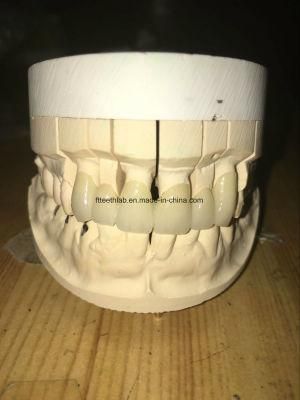 Dental Material Lab Implant Dental Lab Custom Full Ceramic Dental Bridge