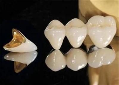 Dentures From China Dental Lab