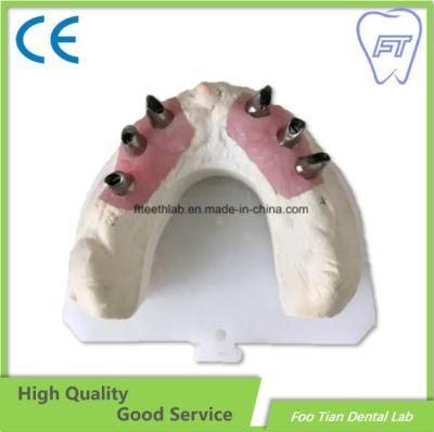 Dental Abutment Custom Abutment Dental Lab on Sale