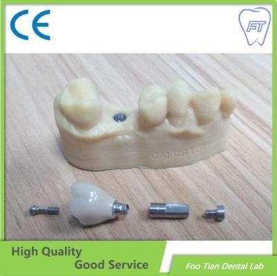 Hot Sale Denture Zirconia Crown with High Aesthetic and Natural Customized