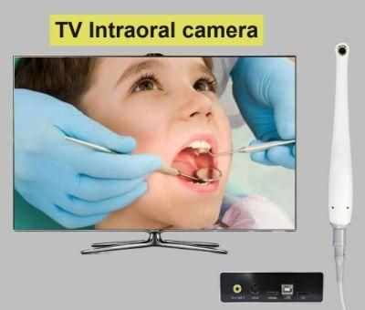 Portable Medical Intra Oral Camera with VGA Output Port Working with TV/Monitor