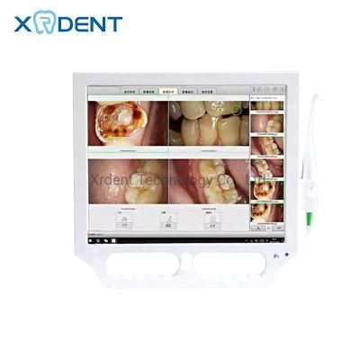 USB Dental Intraoral Camera with LCD Touch Screen Monitor Can Connect with Dental X Ray Sensor and Dental Chair