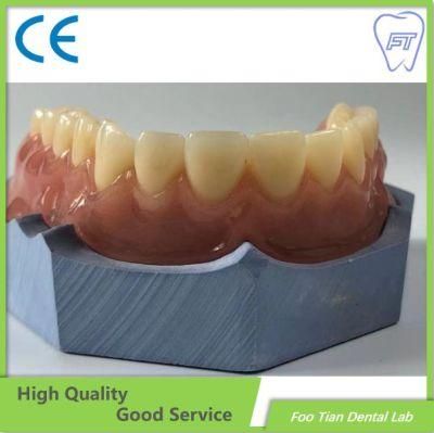 High Quality Removable Denture Cast Partial Framework Dental Customized