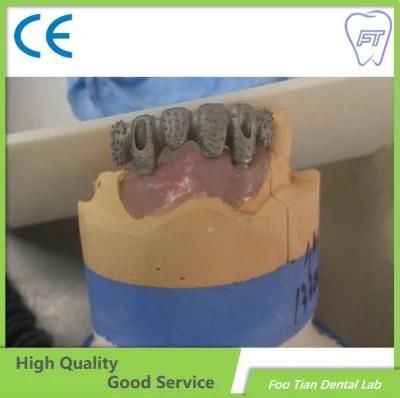 High Aesthetic Dental Zirconium Bridges From China Dental Lab on Selling