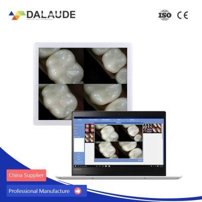 Dental Integrated Endoscope Camera Compatible with Dental Chair